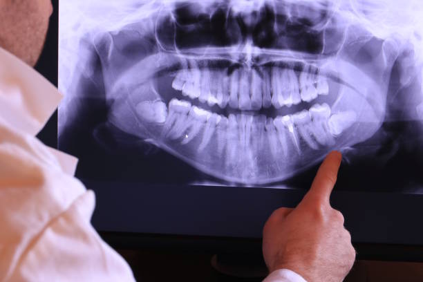 Best Chipped Tooth Repair Near Me  in Averill Park, NY